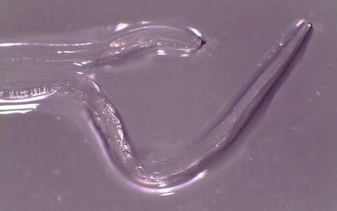 An adult female eye worm, removed from the eye - Credit: U.S. Centers for Disease Control 