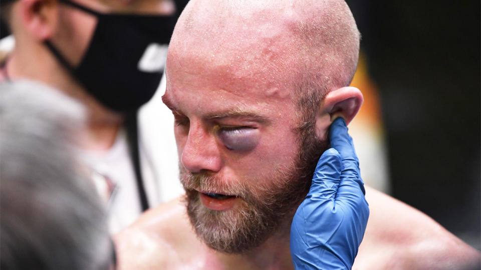 Justin Jaynes' (pictured) eye swelling after being punched.