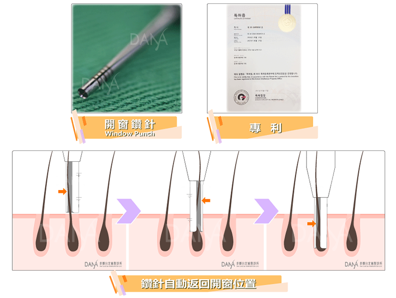 使用特殊機器與專利的開窗鑽針