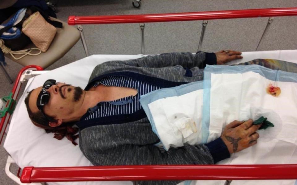 Depp was taken to hospital with a severed finger - Schillings/PA