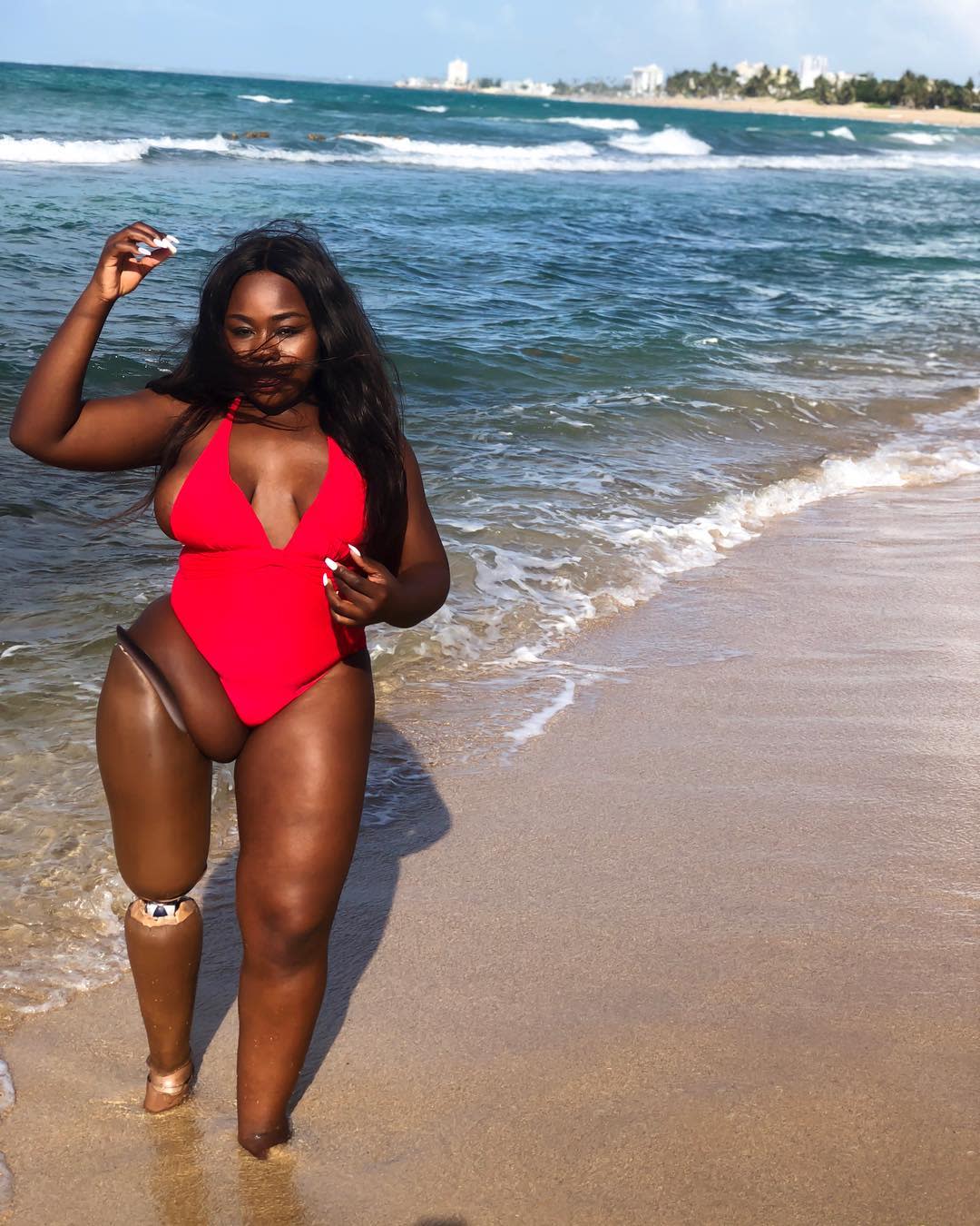This singer-songwriter and amputee is displaying body pride online — and  thousands are taking notice