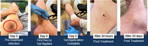 Patient Case Study Example A