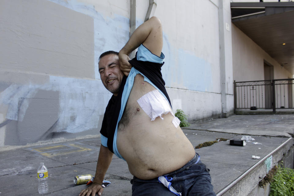 Jeremiah King, who is transitioning out of homelessness, grimaces in pain as he shows the bandage on a gunshot wound as he sits on the street after his hospital release in Portland, Ore., on July 27, 2022. King's assailant has not been arrested. “He turned around and pulled a pistol out and I didn’t see it. I didn’t feel anything at first but 10 seconds later I could hardly breathe,” King said as he sat on street after three nights in a hospital. “I thought I was going to pass away.” (AP Photo/Gillian Flaccus)