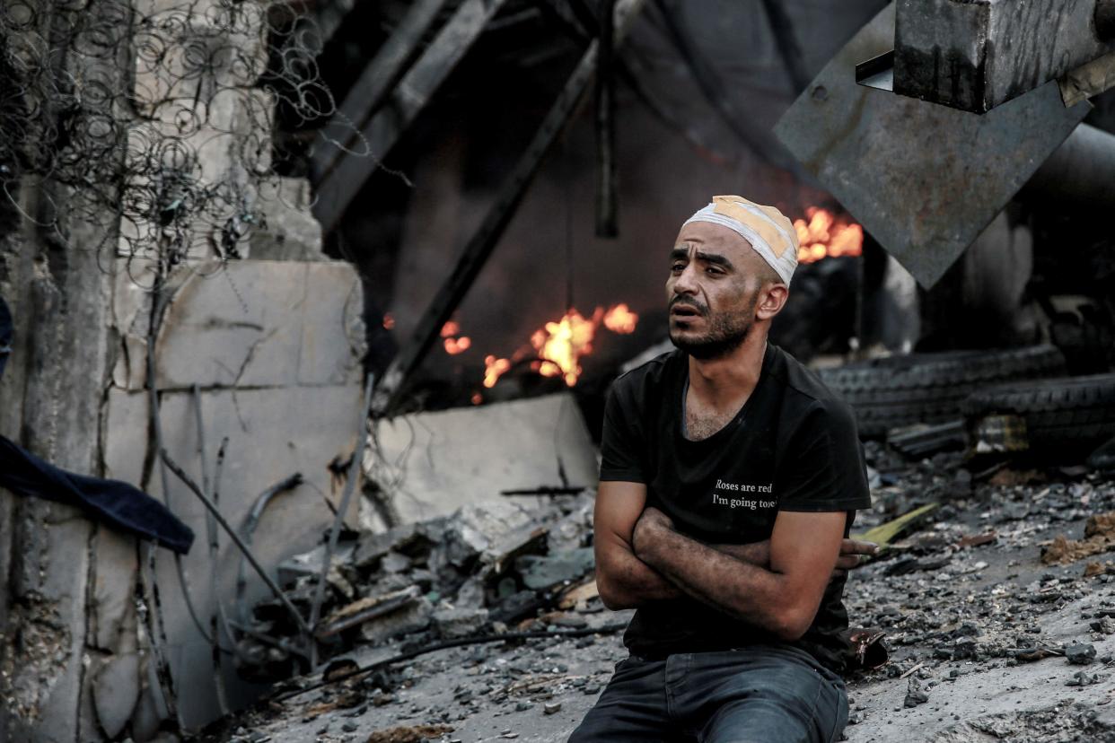 A man with a bandage on his head sits in front of a destroyed building in Gaza after Israeli airstrikes (AFP via Getty Images)