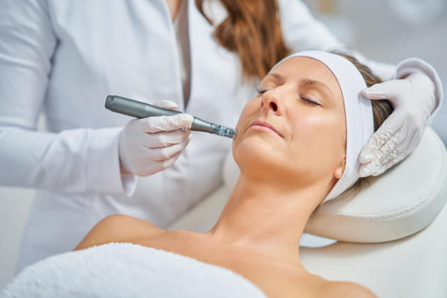 Microneedling Before and Afters: See How It Can Tighten the Neck