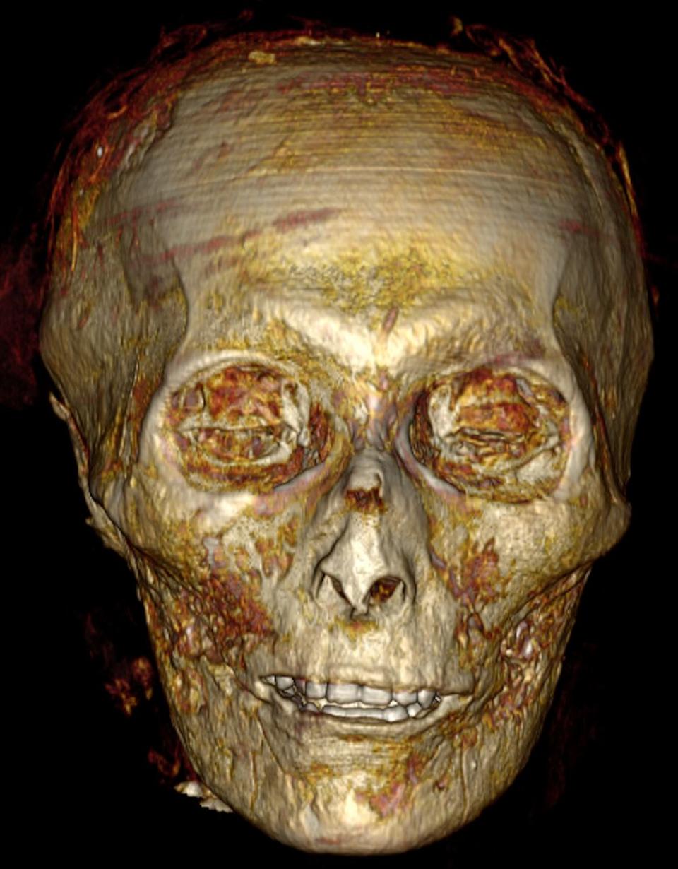 <div class="inline-image__caption"><p>A 3D reconstruction of Amenhotep I's mummified skull.</p></div> <div class="inline-image__credit">S. Saleem and Z. Hawass</div>