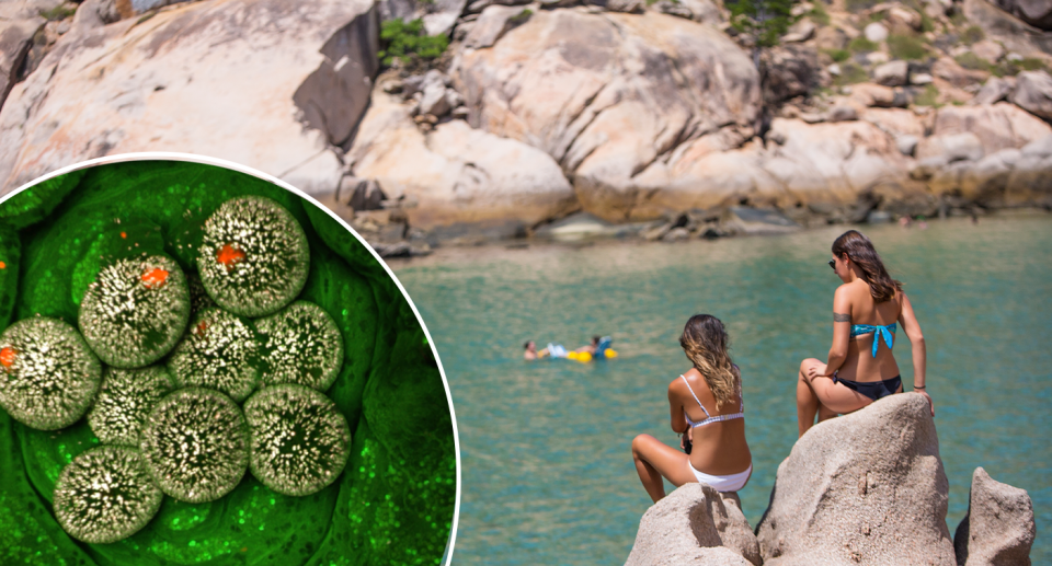 Left - the chlamydia-like bacteria. Right - two women sitting off Magnetic Island over water. 