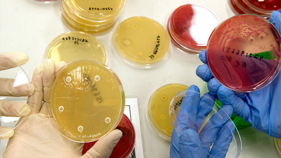 Generic photograph of petrie dishes in a laboratory at the University of Queensland Centre for Clinical Research, Wednesday, February. 3, 2010.