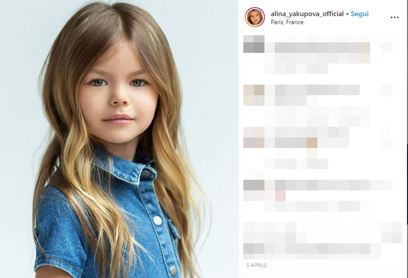 Yakupova è rappresentata dall'agenzia di moda per bambini, President Kids (PK) Management, la stessa che seguiva un'altra giovane modella russa, Anastasia Knyazeva. Quest'ultima si era guadagnata nel 2016, all'età di 6anni, lo scettro di "bambiba più bella del mondo". Prima di loro il titolo era nelle mani della modella francese Thylane Blondeau, figlia del calciatore Patrick Blondeau, che oggi ha 18 anni.