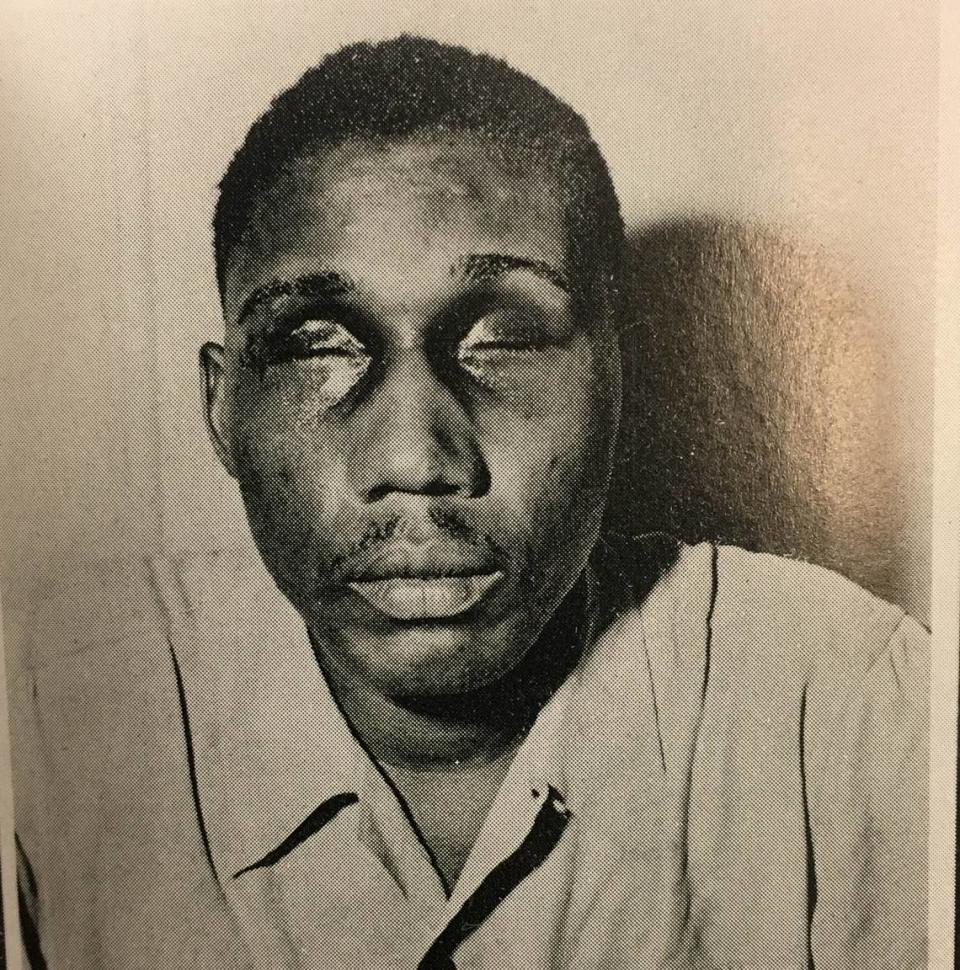 Isaac Woodard was arrested by Batesburg police chief Lynwood Shull. While in custody Woodard was beaten so badly he was blinded.