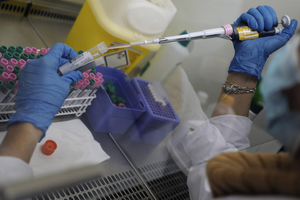 Seminar Kibir, health lab technician prepares chemicals to process analysis of some nasal swab samples to test for COVID-19 at the Hospital of Argenteuil, north of Paris, Friday Sept. 25, 2020. France's health agency announced Thursday evening that the country has had 52 new deaths and has detected over 16,000 new cases of coronavirus in 24 hours. (AP Photo/Francois Mori)