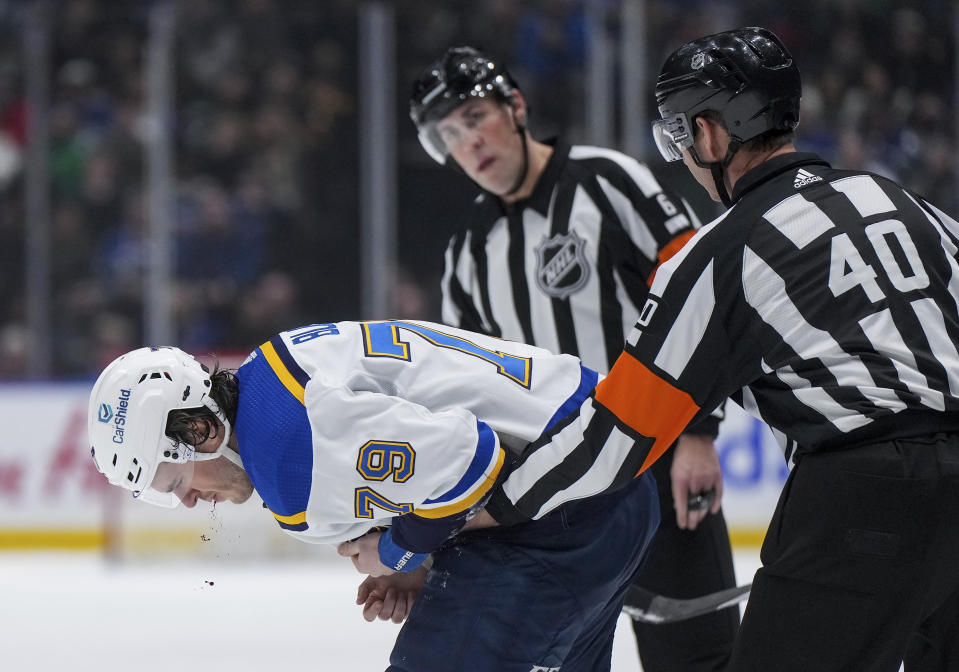 Referee Steve Kozari (40) and referee Francis Charron, back, check on St. Louis Blues' Sammy Blais (79) as he bleeds after taking a stick to the face from Vancouver Canucks' Andrei Kuzmenko during the second period of an NHL hockey game Wednesday, Jan. 24, 2024, in Vancouver, British Columbia. (Darryl Dyck/The Canadian Press via AP)