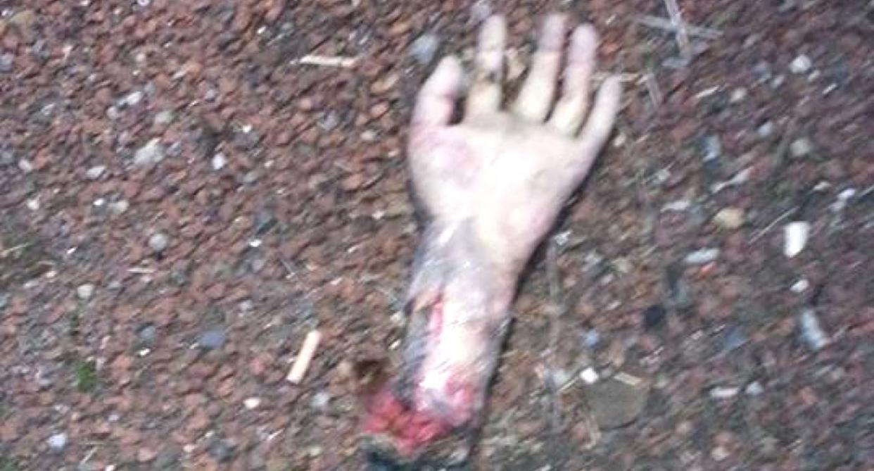 Police found the gruesome-looking 'hand' near the A19 in Middlesbrough. Pic: Cleveland & Durham RPU