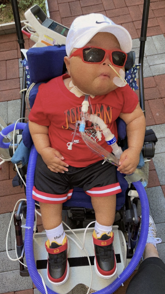 Amir Keys, 2, has gone through several operations in his short lifespan as a result of health complications stemming from his premature birth in November of 2020.