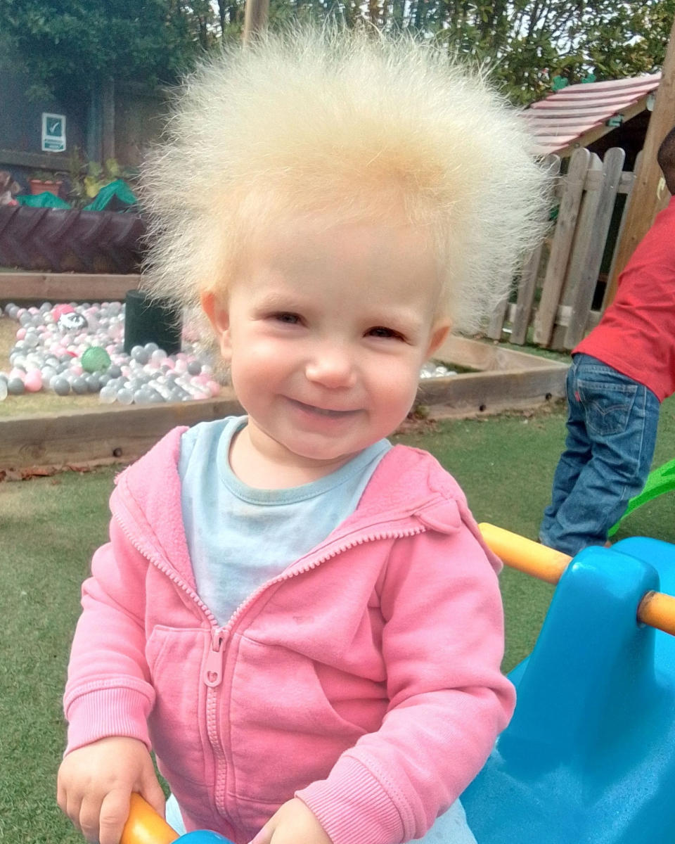 Layla Davis has officially been diagnosed with Uncombable Hair Syndrome (SWNS)
