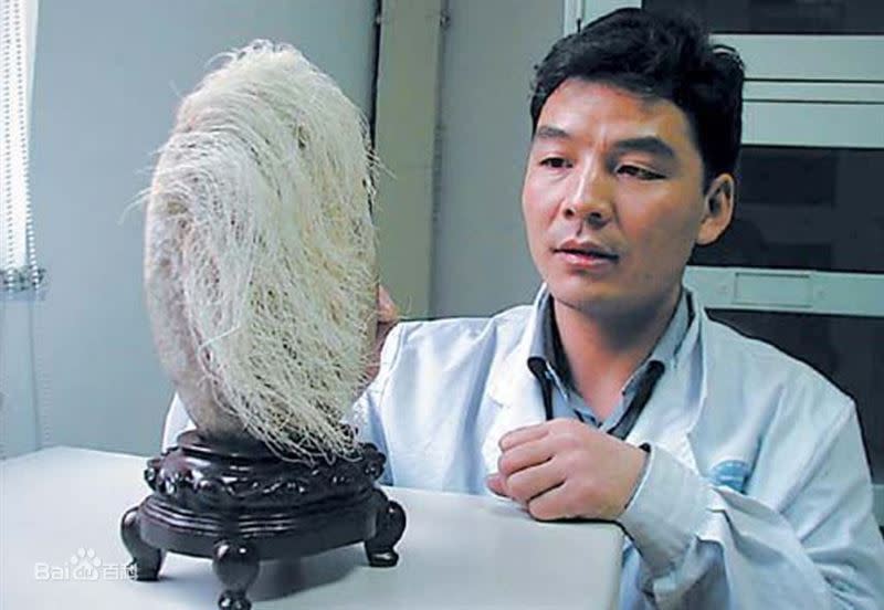 科學家們鑑定，「白髮」為一種新的物種，稱之為「多板直管頭盤蟲」。（圖／翻攝自百度百科）