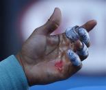 An injury is seen on the hand of Rafael Nadal of Spain during his men's singles quarter-final tennis match against Grigor Dimitrov of Bulgaria at the Australian Open 2014 tennis tournament in Melbourne January 22, 2014. REUTERS/Bobby Yip