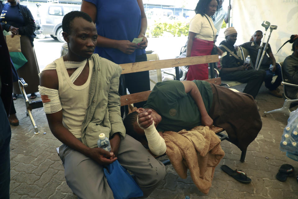 Residents who suffered burns following a fire caused by a vehicle loaded with gas which exploded, receive treatment at Mama Lucy Hospital in Nairobi, Kenya, Friday, Feb. 2, 2024. The truck explosion ignited a huge fireball, and a flying gas cylinder set off a fire that burned down the Oriental Godown, a warehouse that deals with garments and textiles, according to government spokesman Isaac Mwaura. (AP Photo)