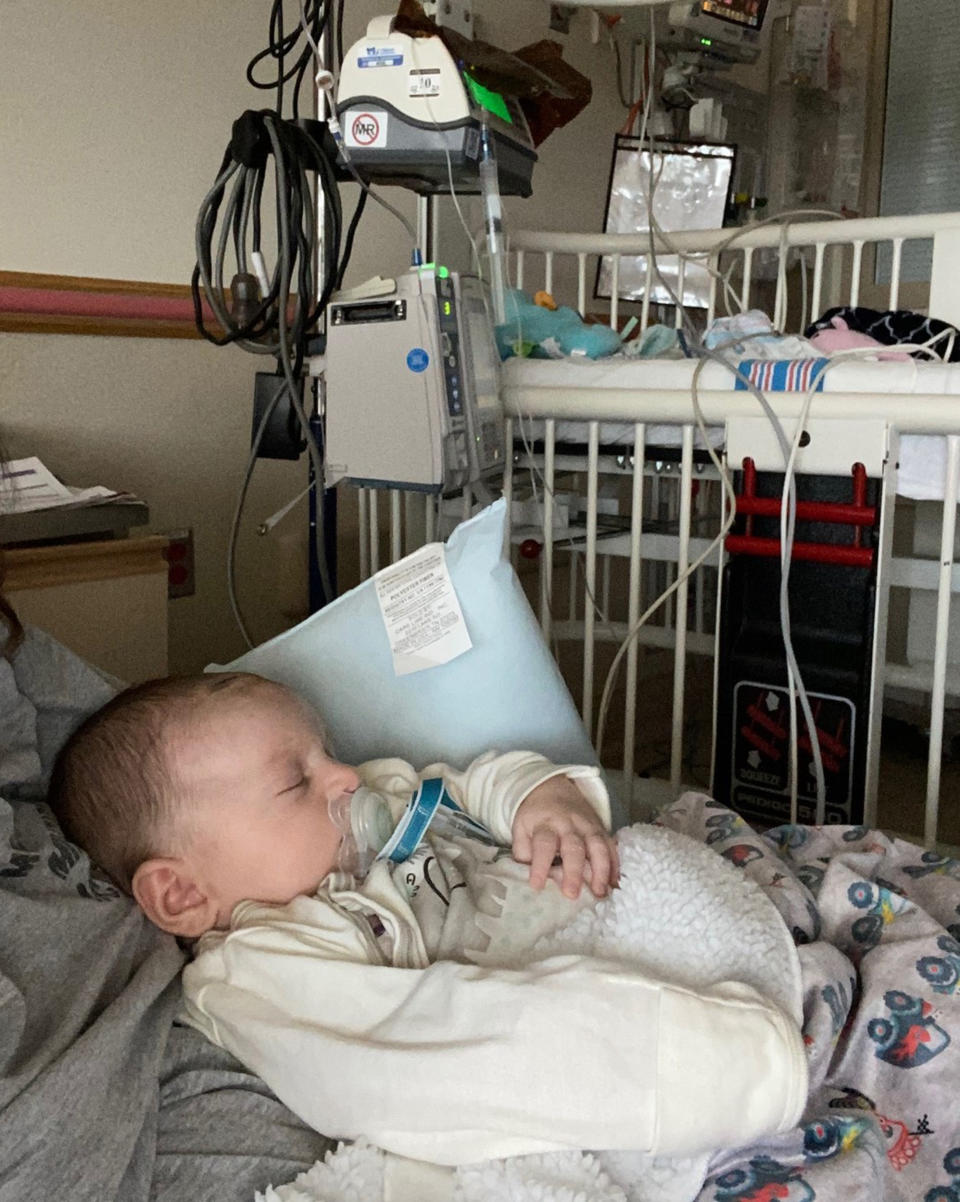 To help Parker develop an immune system, doctors gave him chemotherapy and a bone marrow transplant. After this procedure, babies often need to stay close to the hospital for months, but Parker was doing so well he went home early.  (Courtesy Tiffany Green)