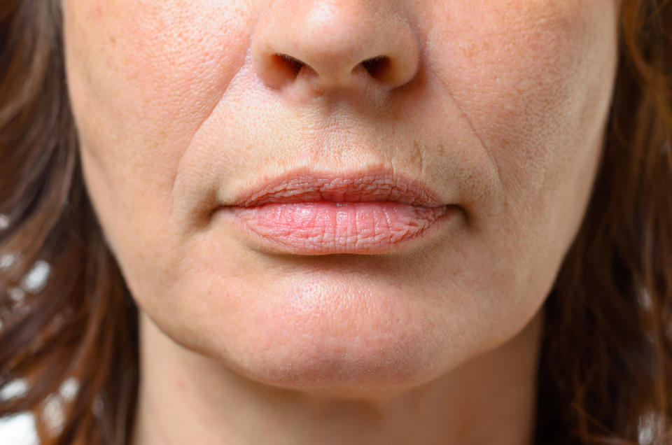 Close-up of an unidentified person's lower face, showing nose and lips.