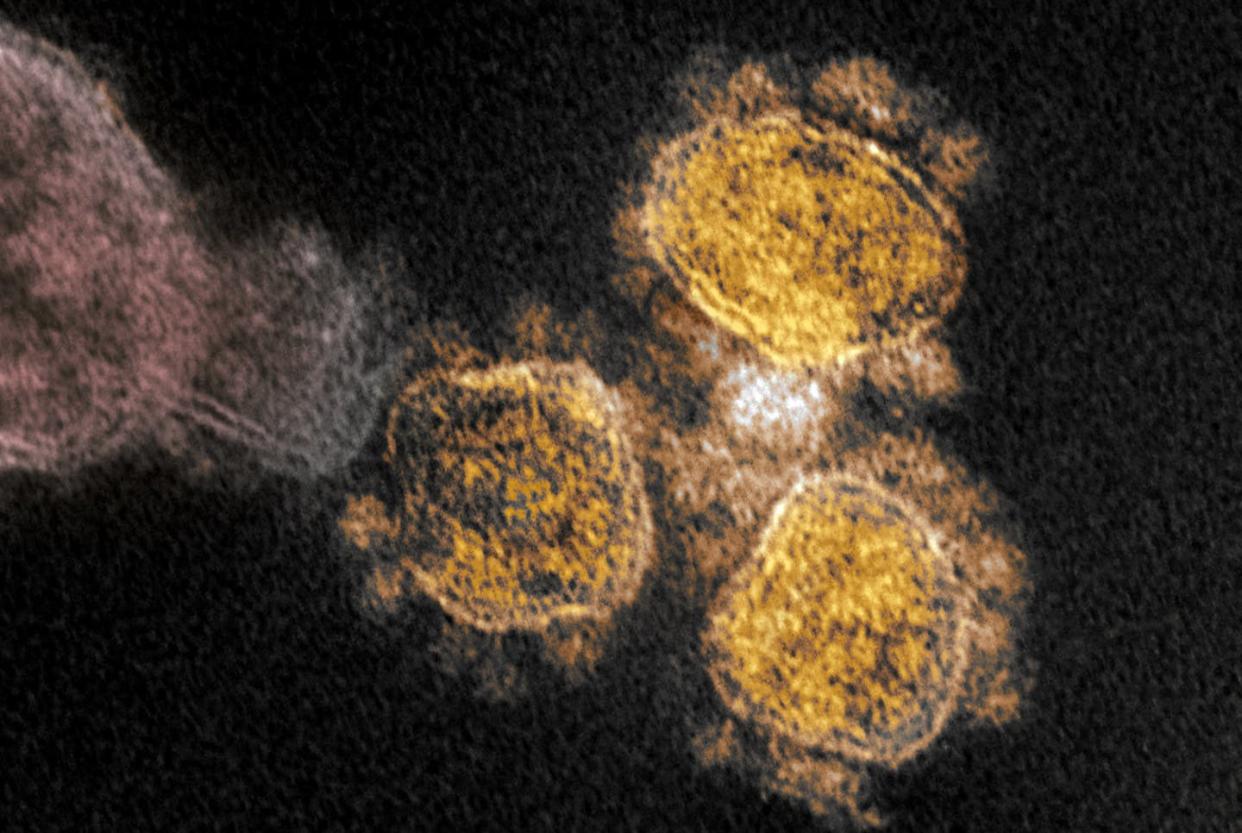 <span class="caption">The new SARS-CoV-2 variant's increased transmissibility is believed to come from a change in the spike protein, visible here in yellow under an electron microscope.</span> <span class="attribution"><a class="link " href="https://www.flickr.com/photos/niaid/49557550836/" rel="nofollow noopener" target="_blank" data-ylk="slk:National Institute of Allergies and Infectious Diseases;elm:context_link;itc:0;sec:content-canvas">National Institute of Allergies and Infectious Diseases</a></span>