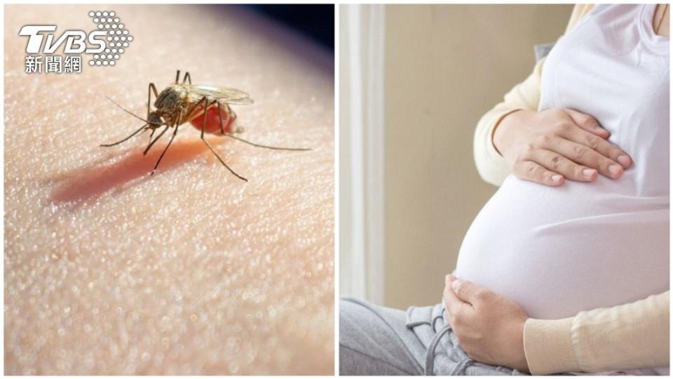 孕婦左小腿腫脹原因竟是被蚊子叮後造成的。（合成示意圖／shutterstock達志影像）