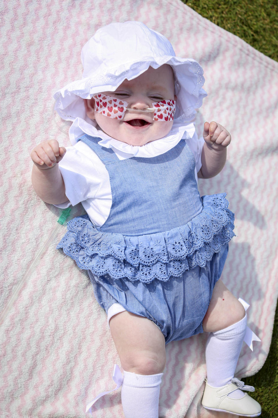 Elsie, now 10-months-old, was born weighing just 1lb 1oz when she arrived 17 weeks early. (Image supplied/SWNS)