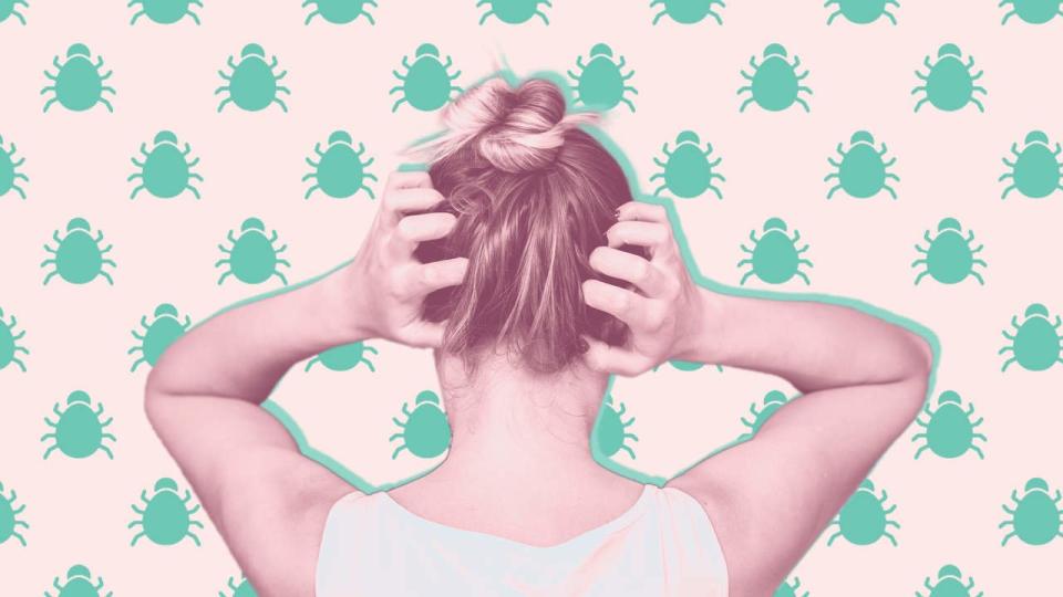 These Are the 20 Best Lice Treatments, According to Experts