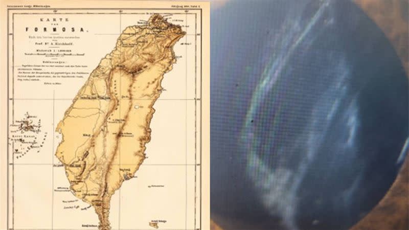 患者的眼部因後白內障出現台灣地圖。（圖／洪啟庭提供）