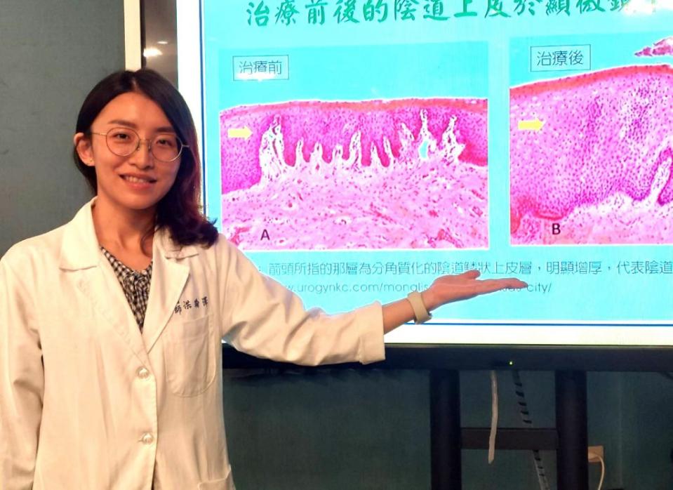 醫師洪瑜澤說，陰道雷射可有效治療婦女更年期生殖泌尿症候群，成為治療新選擇。（記者葉進耀攝）