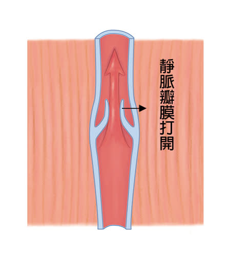 正常的靜脈瓣膜開合，能導引血液單方向流動