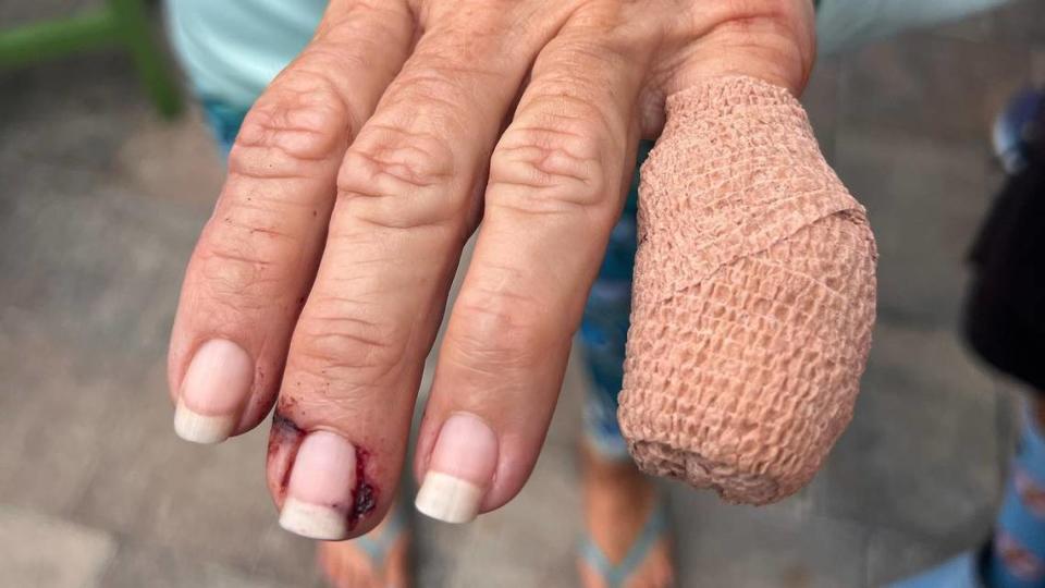 Leiza Fitzgerald was taken to the hospital after her fingers got caught in the fishing line during a tarpon fishing tournament in Tampa Bay. Courtesy of Leiza Fitzgerald