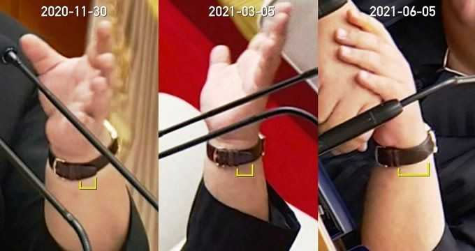  金正恩手腕配戴的瑞士名錶可發現，他體重可能正逐漸減輕。（圖／翻攝自NK News）