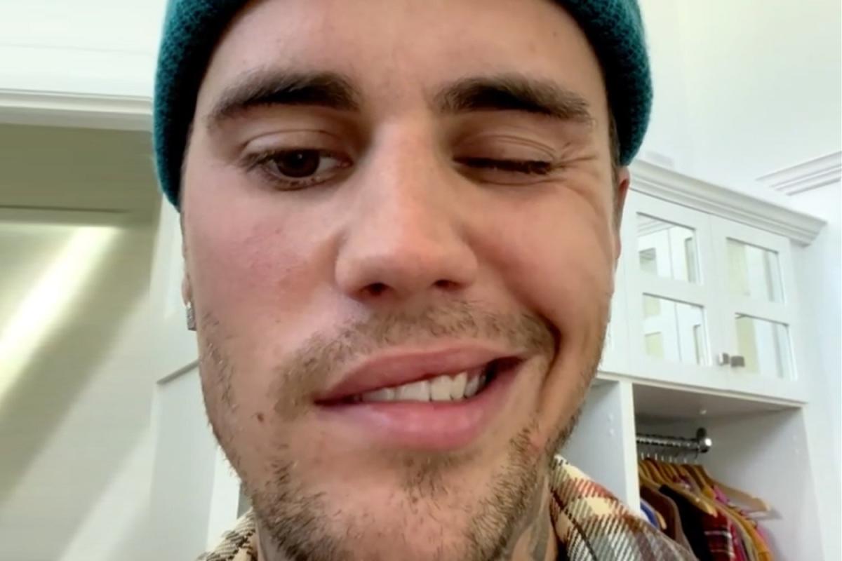 Justin Bieber Reveals He Has Ramsay Hunt Syndrome and His Face Is Partially  Paralyzed: 'I Have Hope'