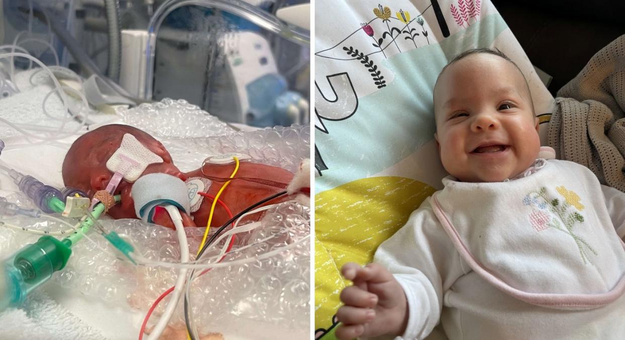 A premature baby born weighing just 535g has now celebrated her first birthday. (Lauren Ormston/SWNS)