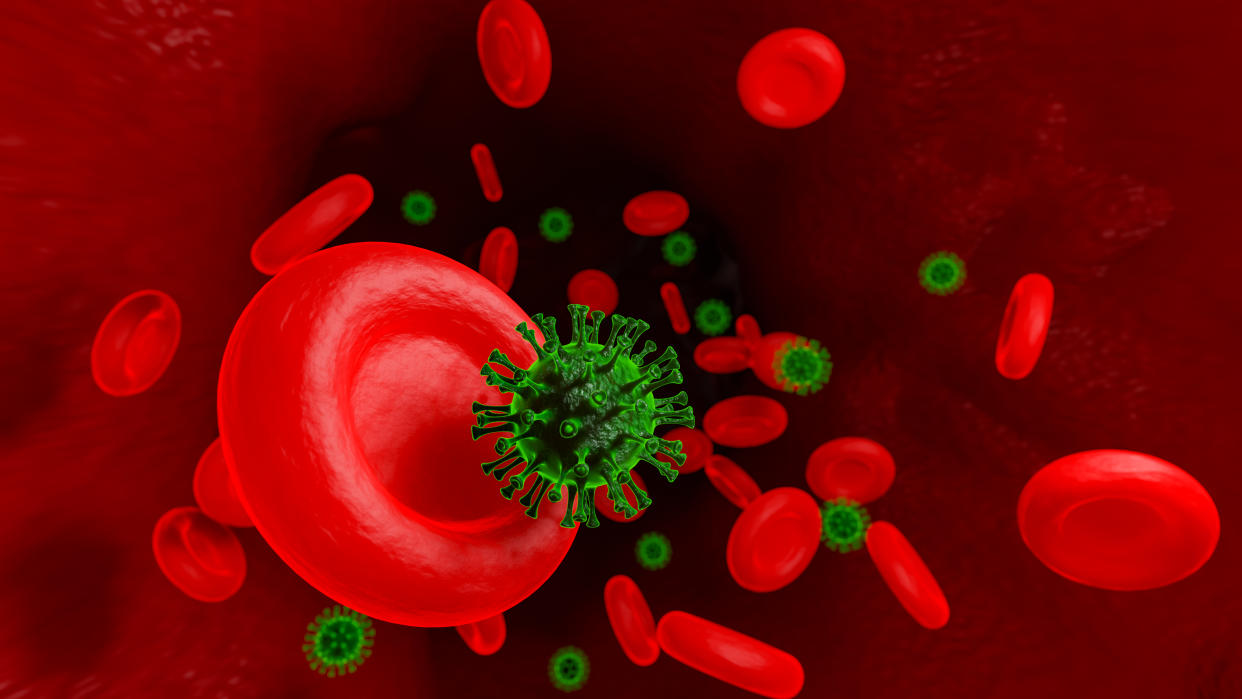 La trombosis de senos venosos cerebrales (TSVC) vinculada a las vacunas de AstraZeneca y Johnson&Johnson, podría originarse a través de la respuesta inmune (anticuerpos) que activan las plaquetas (vía PF4) generando trombos, y entorpeciendo el flujo sanguíneo. (Foto: Getty)