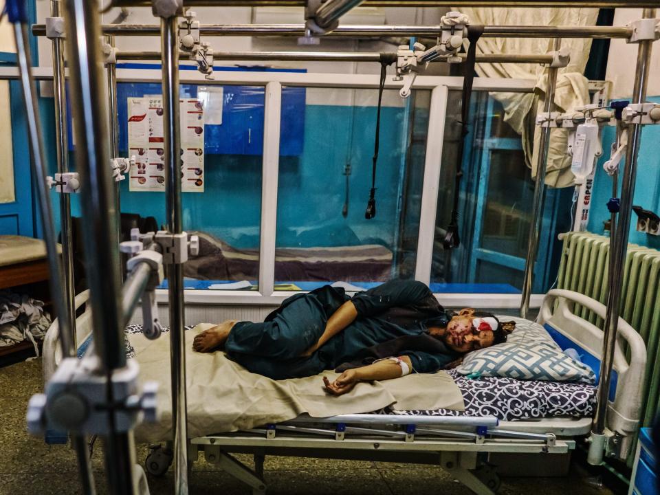 A wounded patient lays in the recovery unit at Wazir Akbar Khan Hospital. in Kabul, Afghanistan, Thursday, Aug. 26, 2021