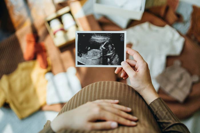 A woman is holding up a sonogram