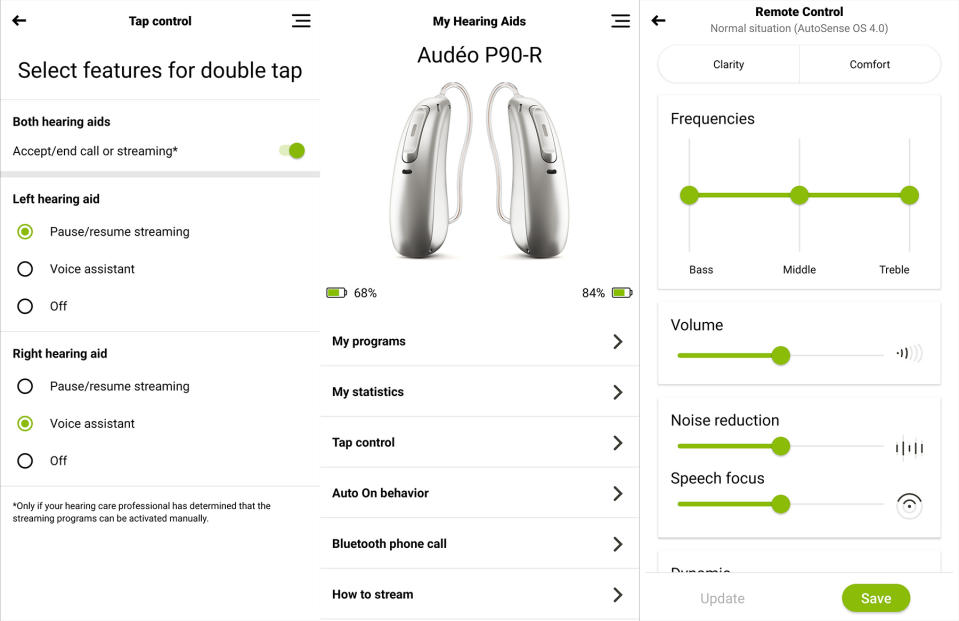 Phonak Paradise App.