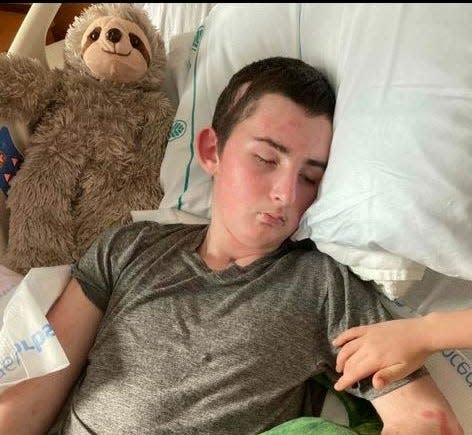 Flat Rock Middle School student Aidan Burnette is still recovering from his injuries after being hit by a car after getting of his school bus on Feb. 14.