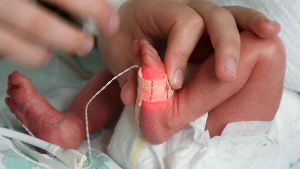 Eltern von Frühchen sollen künftig einen Monat länger Elterngeld erhalten, wenn das Kind mindestens sechs Wochen vor dem errechneten Geburtstermin zur Welt gekommen ist.