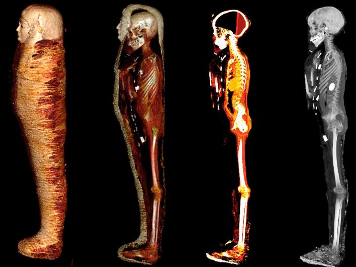 A side view of the mummy is shown at four different depths, the first with just the bandages, then the cartonnage with the body, then inside the body, then just the skeleton.