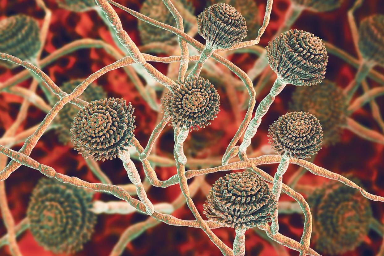 The fungus Aspergillus fumigatus. This fungus can cause a number of disorders in people with compromised immune function or other lung diseases. Kateryna Kon/Science Photo Library/GettyImages