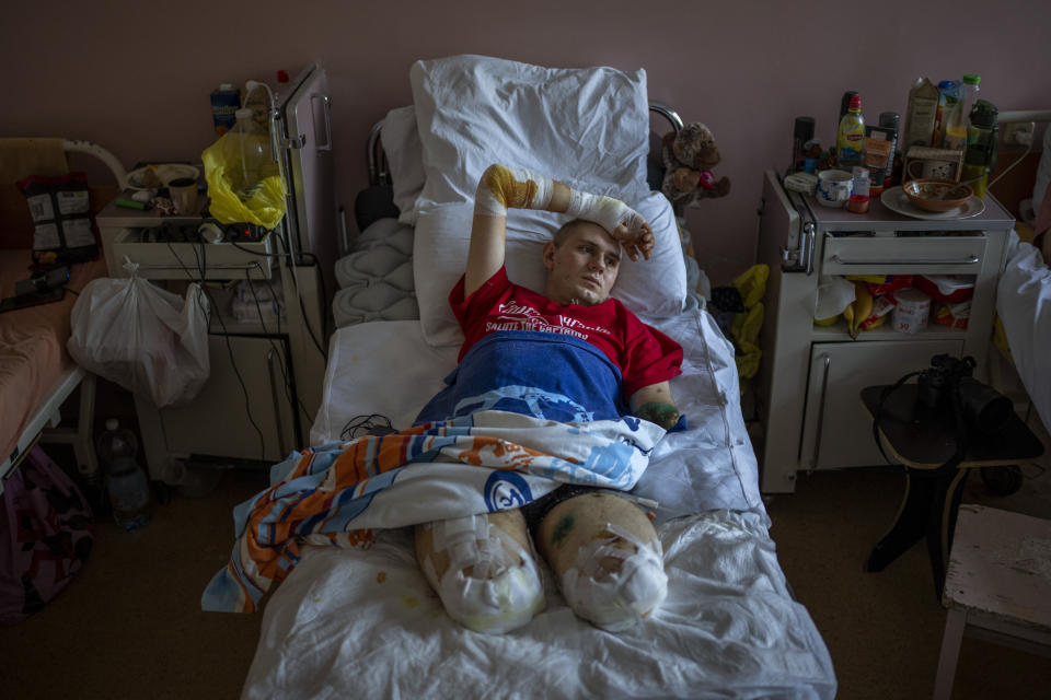 Anton Gladun, de 22 años, yace en su cama en el Tercer Hospital Municipal, el 5 de mayo de 2022, en Cherkasy, Ucrania. Gladun, un médico militar emplazado en el frente en el este de Ucrania, perdió ambas piernas y el brazo izquierdo el 27 de marzo debido a la explosión de una mina. (AP Foto/Emilio Morenatti)