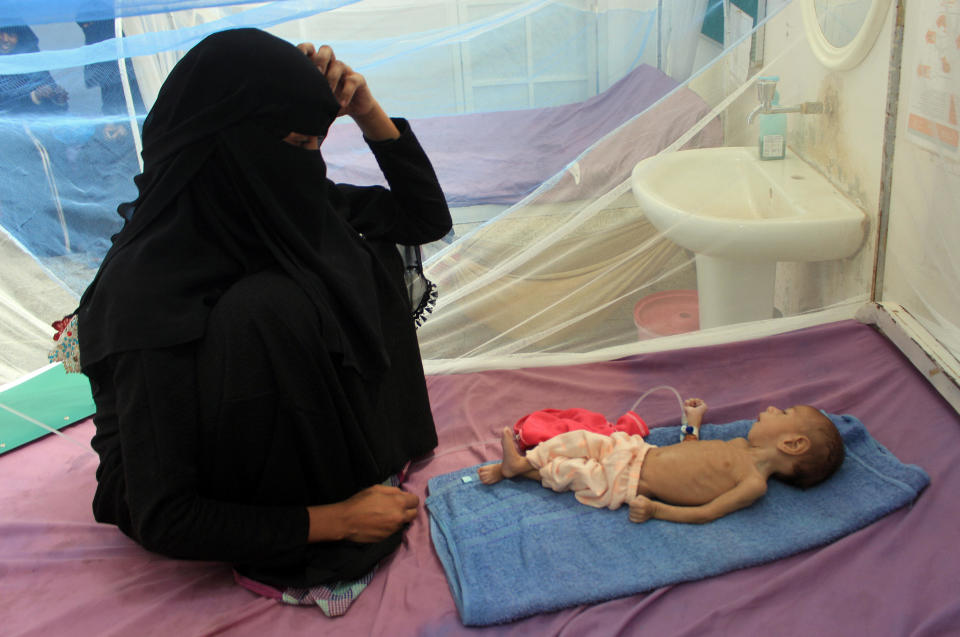 A woman sits with a Yemeni child suffering from malnutrition during treatment at a malnourishment care center in Yemen's northern Hajjah province, January 20, 2021.  / Credit: ESSA AHMED/AFP/Getty