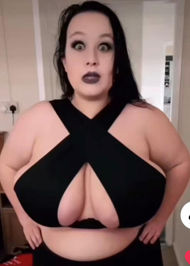 Woman with 44GG-sized boobs gets breast reduction following years