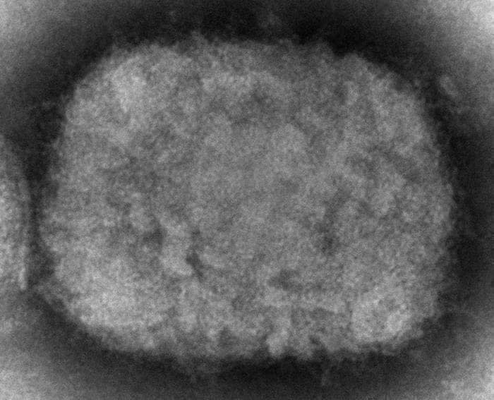 FILE – This 2003 electron microscope image made available by the U.S. Centers for Disease Control and Prevention shows a monkeypox virion, obtained from a sample associated with the 2003 prairie dog outbreak. Two children have been diagnosed with monkeypox in the United States: a toddler in California and an infant who is not a U.S. resident, health officials said Friday, July 22, 2022. (Cynthia S. Goldsmith, Russell Regner/CDC via AP, File)