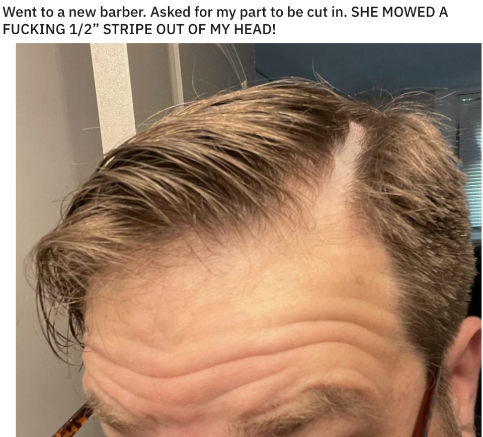 A bad haircut on a man