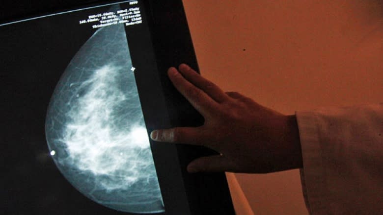 N.L. has highest rates of mastectomies in Canada: researchers want to know why