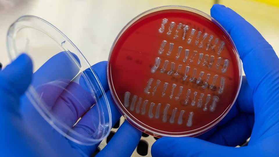 A medical-technical assistant prepares E-coli strains for analysis. - Hendrik Schmidt/picture alliance/Getty Images